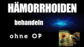 Hämorrhoiden behandeln ohne OP