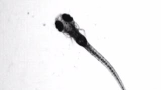 Fluorescent Fish and Skin Cancer | Cancer Research UK