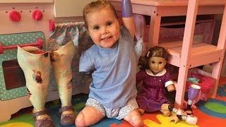Quadruple Amputee Toddler Gets Custom American Girl Doll: "Mummy, She's Like Me!"