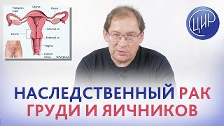 РАК ЯИЧНИКОВ: как ВЫЯВИТЬ ПРЕДРАСПОЛОЖЕННОСТЬ. Как распознать рак яичников на ранней стадии.