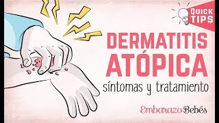 #DERMATITIS ATÓPICA en Bebés y Niños ??❌