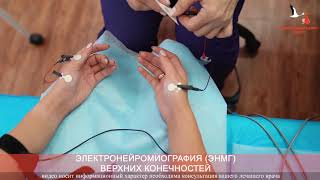 Электронейромиография ЭНМГ верхних конечностей в Хабаровске