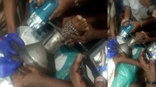 Indian woman's leg gets stuck in train toilet, railway police rescue