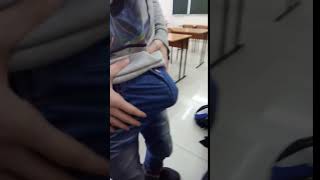 Пацану сломали синтоловый член