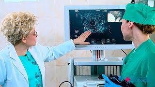 Здоровье. Рак желудка. Новый метод диагностики.(14.05.2017)