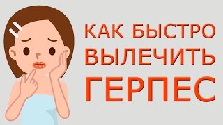 Как быстро вылечить герпес в домашних условиях. Лечение герпеса на губах, герпес зостер лечение