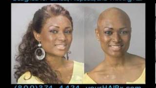 Wigs for Alopecia, Cancer and Thinning Hair