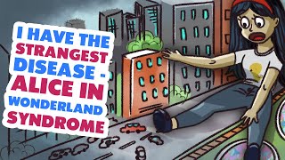 I Have the Strangest Disease - Alice in Wonderland Syndrome