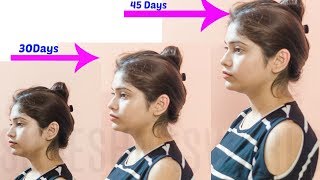 INCREASE YOUR HEIGHT SUPER FAST | Increase height after 30 | How to become tall