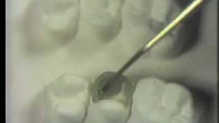 Waxing Exercise - Part 2