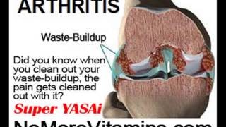 High Arch Foot Pain by NoMoreVitamins com