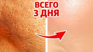 КАК НАВСЕГДА УМЕНЬШИТЬ ПОРЫ И ИЗБАВИТЬСЯ ОТ ПРЫЩЕЙ