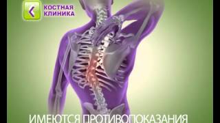 Экстракорпоральная ударно-волновая терапия