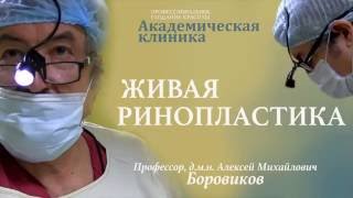 Открытая ринопластика.  Профессор Боровиков А. М.