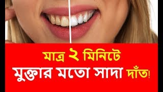 হলুদ দাঁত সাদা করার ঘরোয়া উপায়।teeth whitening method/Falgun's Daily Tips