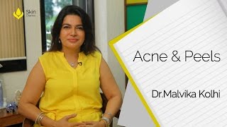 Best Peels For Acne By Dr. Malvika Kohli || Skin Diaries