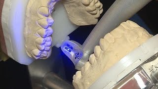 Le dentiste du futur - hi-tech