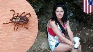 Жительница Оклахомы лишилась всех конечностей из-за укуса клеща