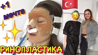 РИНОПЛАСТИКА в Турции?? Показываю ВСЕ- ВСЕ
