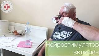 Отзыв пациента после операции по имплантации нейростимулятора при эссенциальном треморе.