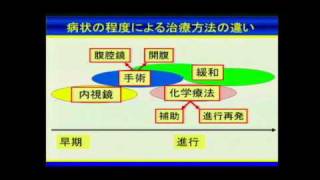 大腸がんの予防から検診・手術まで