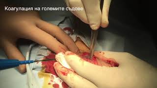 Класическо обрязване (циркумцизия)