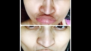 Pack to Get Reduce Tan , Pigmentation , Uneven Skin Tone, Acne Scars and Get an INSTANT GLOW