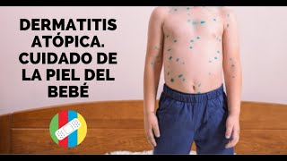 Dermatitis Atópica. Cuidado de la piel del bebé