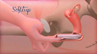 Come usare Softcup