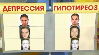 Депрессия и гипотиреоз. Жить здорово! (12.04.2016)
