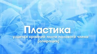 Пластика уздечки крайней плоти полового члена (урологическая операция). Без рубцов, без боли.
