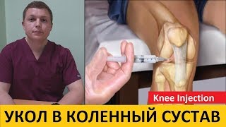 Внутрисуставные инъекции в коленный сустав | Knee Injection