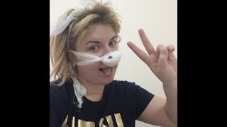 Мой рассказ о том как я пережила операцию на нос ( искривление носовой перегородки и вазотомия)