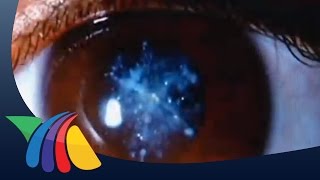 Enfermedades que causan baja visión | Noticias de Salud