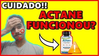 ? Actane - Actane funciona? Actane Onde comprar? Actane site oficial? Actane Depoimento Resultados