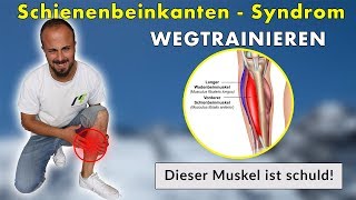 Shin Splints, Schienenbeinkantensyndrom | Die 3 Besten Übungen | Ursache & Lösung