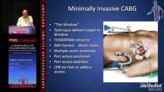 Coronary Artery Bypass (Mahesh Ramchandani, MD)