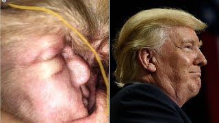 This Dog's Ear Oddly Looks Just Like President Donald Trump