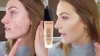 Lancome Teint Idole Ultra Long Wear Foundation Review | Cover Acne, Pale Skin