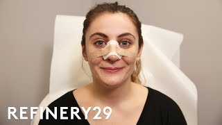 I Got A Nose Job To Match My Identity | Refinery29