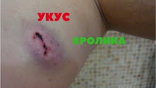Укус фландра.  Как кусаются кролики