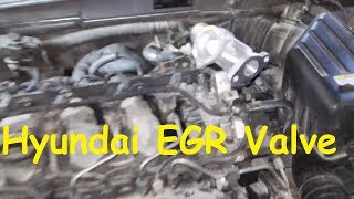 Hyundai Sonata EGR problem / EGR Valve replacement Hyundai /EGR Cleaning