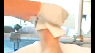 Amputation of toe bandage removal