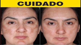 BEAUTY CLEAN CREME CLAREADOR - BEAUTY CLEAN FUNCIONA? BEAUTY CLEAN ONDE COMPRAR O ORIGINAL