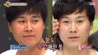 '팔자 주름을 없앤다?' 기적의 성형 마사지 @놀라운 대회 스타킹 131026
