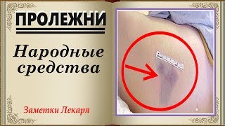 Как лечить пролежни  Проверенные народные рецепты лечения