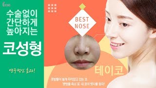 콧방울 축소 코성형 루체아 테이코