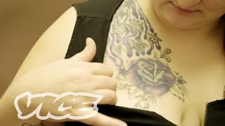 Unbranded: Sex Trafficking Tattoo Removal