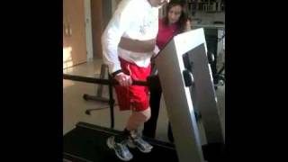 Trilateral Amputee Walking with C-leg on a treadmill