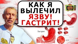 КАК Я ВЫЛЕЧИЛ ЯЗВУ, ГАСТРИТ! Островский. Что делать, если гастрит, язва желудка. Ответы на вопросы